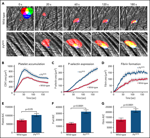 Laser-induced injury in WT vs FV Leiden mice. (A) Time lapse images from representative WT (top row) and FVQ/Q mice (bottom row) after laser injury in cremaster arterioles. Images are binary representations of 2D confocal fluorescence images overlaid on the brightfield. Platelets are shown in red, P-selectin+ area in green, and fibrin area in blue (overlay colors are shown in the color wheel). White arrow indicates the direction of blood flow. Scale bar in each image, 10 μm. (B-D) Graphs show CD41+, P-selectin+, and fibrin+ areas over time after laser injury of cremaster arterioles in WT (red) and FVQ/Q (blue) mice. Values are mean ± standard error of the mean (SEM). (E-G) Graphs show area under the curve (AUC; mean ± SEM) for platelets and P-selectin and fibrin areas over time. Statistics were calculated using the Mann-Whitney test; n = 49 injuries from 4 WT mice and 46 injuries from 4 FVQ/Q mice.