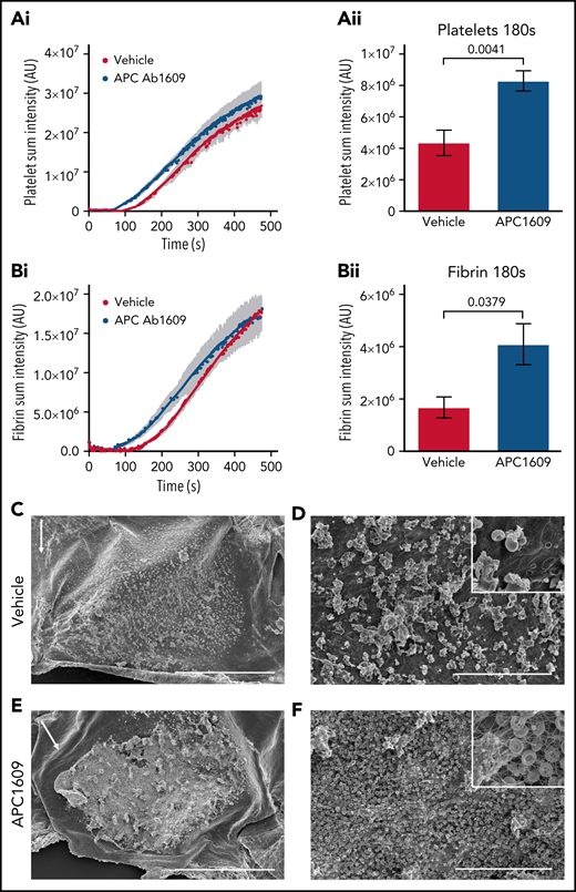 Inhibition of APC enhances thrombus formation after FeCl3 injury of the mouse jugular vein. (A) Graphs show platelet accumulation in vehicle- (red) and Ab1609-treated (blue) mice after FeCl3 induced injury of the mouse jugular vein: platelet accumulation over the entire time course of the experiment (i), and platelet accumulation 180 seconds post-FeCl3 removal (ii). (B) Corresponding graphs showing fibrin accumulation after FeCl3 induced injury. All values are mean ± standard error of the mean. Statistics were performed using the Mann-Whitney test; n = 7 vehicle- and 7 Ab1609-treated mice. (C-F) Scanning electron microscopy images of the intravascular side of the jugular vein after FeCl3 injury. (C-D) Representative thrombus formed in a vehicle-treated mouse 3 minutes after removal of FeCl3. Scale bars, 500 and 30 μm, respectively. (E-F) Corresponding images of a representative thrombus from an Ab1609-treated mouse. Insets in panels D and F show a higher-magnification view of the vessel surface; note the exposed endothelium and lack of fibrin formation in the vehicle-treated mouse (panel D inset) vs a fibrin-, red blood cell–, and platelet-rich thrombus in the presence of Ab1609. White arrows indicate the direction of blood flow (C,E). Images are representative of n = 4 mice in each group (images from additional mice are included in supplemental Figure 9).