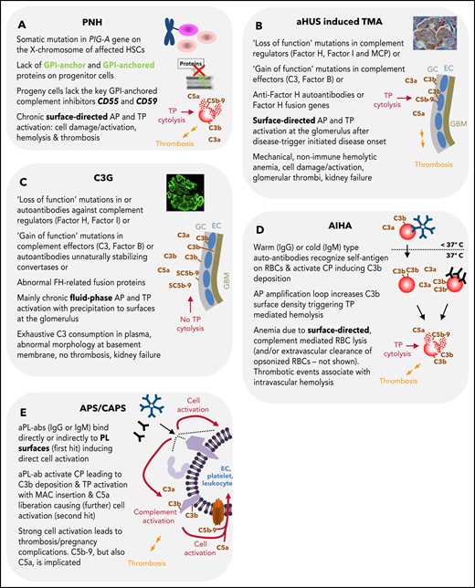 Summary of features for diseases with substantial complement involvement. (A) PNH. Acquired somatic mutations in the PIG-A gene (encoding a glycosyl transferase essential for the synthesis of GPI anchors) of hematopoietic stem cells result in a loss of or in reduced numbers of GPI anchored proteins on the surface of progenitor cells (erythrocytes, platelets, leukocytes, lymphocytes). Consequences thereof are highlighted in the figure. (B) aHUS-induced TMA. Different heterozygous mutations are linked to causing the disease. Gain-of-function mutations in complement components, loss of function mutilations in complement regulators, loss of function because of hybrid genes of the regulator factor H, or autoantibodies directed against factor H are the main contributors to aHUS inducing an imbalance in complement activation/regulation after a complement activation trigger (eg, infection, surgery; DGKE type aHUS is not covered). Key events in aHUS-induced TMA are summarized in the figure. GC, glycocalyx; EC, endothelial cells; GBM, glomerular basement membrane. (C) C3G. Like in aHUS, gain-of-function mutations of complement effector proteins or loss of function mutations in regulators are described. In addition, FH-related fusion proteins and autoantibodies either stabilizing the intrinsic short-lived convertases complexes or impairing complement regulators are reported. This leads to AP dysregulation in the fluid phase, which precipitates onto surfaces apparently without inflicting widespread cytolysis. Although TP activation products are identified in the glomeruli of patients, the C5b-9 complexes appear to be inhibited by the fluid phase inhibitors vitronectin (S protein) and/or clusterin yielding SC5b-9, which cannot insert into membrane bilayers. (D) AIHA. Cold-type autoantibodies bind to erythrocytes at temperatures lower than 37°C and induce covalent C3b deposition that is amplified via the AP amplification loop. At 37°C, the low-affinity IgM antibodies regularly dissociate. If high enough C3b densities are reached, TP-mediated cytolysis occurs via MAC. The sequence of events is similar for warm-type antibodies (usually IgG); however, these (high-affinity) antibodies bind and remain bound to red blood cells (RBCs) at 37°C. Not all IgG antibodies can activate the CP (strong enough) to lead to MAC formation and intravascular hemolysis. If not lysed, IgG and/or C3-fragment positive RBCs are recognized by phagocytes of the reticuloendothelial system (RES), resulting in extravascular removal of such RBCs without intravascular hemolysis (data not shown). Erythrocyte lysis within the vasculature is associated with thrombotic events. (E) APS/CAPS. aPL-abs are a heterogenous group of autoantibodies (mostly IgG and IgM, but IgA also occur) targeting complexes of PLs and PL-binding proteins. Occurrence of aPL-ab– and antibody binding–induced cell activation is considered first hit. Complement activation and signaling via TP activation products C5b-9 and C5a are considered second hit. The role of complement activation in augmenting thrombotic is well documented but may not explain all thrombotic events in APS.