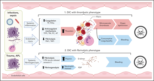 Pathogenesis of thrombotic and fibrinolytic phenotypes of DIC. DIC with a thrombotic phenotype is induced by the exposure of pathogens/PAMPs, cell debris/DAMPs, and NETs to circulating blood, leading to systemic inflammation and endothelial injury. These events promote activation of coagulation and depression of anticoagulant and fibrinolytic activities, leading to uncontrolled thrombin generation and microvascular thrombosis. When fibrinogen and other clotting factors are consumed; bleeding is a frequent outcome. Microvascular thrombosis and bleeding can be equally damaging to the tissues and organs, frequently contributing to death. DIC with fibrinolytic phenotype occurs more frequently in trauma and APL. In these cases, excessive fibrinolysis due to massive release of t-PA and plasmin generation can destroy the early hemostatic clots releasing fibrin fragment D-dimer. In APL, cell surface annexin II binds t-PA and protects its action from inhibitors, thus enhancing plasmin generation and fibrin degradation. Proteases, such as neutrophil elastase and cathepsins, released by leukocytes during inflammation and trauma, degrade fibrinogen and fibrin, leading to the formation of fibrinogen degradation products that further increase bleeding risk and contribute to organ failure and death. TAFI, thrombin activatable fibrinolysis inhibitor.