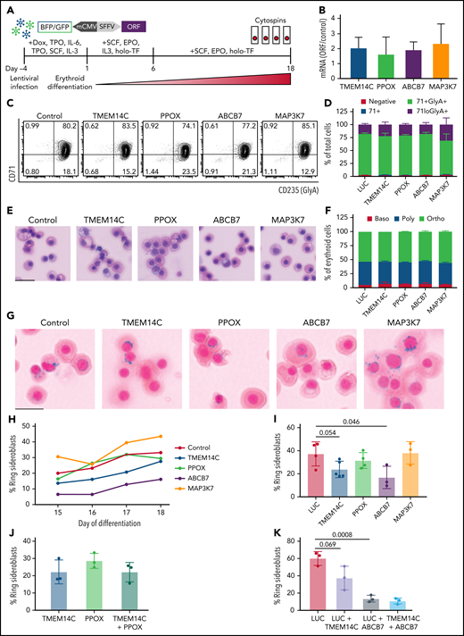 Rescue of TMEM14C and ABCB7 reduces RS formation. (A) Schematic of the functional RS rescue experiments. SF3B1-mutant 5F-HPCs were transduced with lentiviruses overexpressing individual ORFs or LUC control to 50-70% transduction efficiency. To induce differentiation, doxycycline was removed and cells were moved into erythroid differentiation media containing SCF, EPO, IL-3, and holo-TF (without exogenous iron) for 6 days prior to the removal of IL-3 from culture. Cytospins were collected between days 15 and 18 as indicated and stained for RS with Prussian blue. (B) ORF mRNA overexpression level measured by quantitative PCR and normalized to LUC control at day 15 of erythroid differentiation; mean ± SD of n = 3 independent experiments. (C) Representative CD71 and GlyA flow plots of SF3B1-mutant cells expressing each ORF or LUC control on day 18 of erythroid differentiation. CD71 and GlyA staining is indicative of the stage of erythroid differentiation. (D) Erythroid differentiation staging using CD71 and GlyA levels as measured by flow cytometry using gating strategy shown in 4C at day 18 of erythroid differentiation; mean ± SEM of n = 3. (E) Representative May-Grunwald Giemsa staining of erythroid cell morphology on day 18 of erythroid differentiation. Scale bar = 25 mm. (F) Quantification of erythroid cell morphology using May-Grunwald Giemsa staining from day 18 of erythroid differentiation; 2 independent experiments. (G) Representative cytospin images of erythroid cells expressing each ORF or LUC control stained with Prussian blue iron staining for RS quantification. Scale bar = 25 mm. (H) Quantification of RS counts in SF3B1-mutant cells expressing each ORF or LUC control over the course of days 15-18 of erythroid differentiation. Mean values are shown for each day, TMEM14C, ABCB7, LUC control n = 3 independent experiments; PPOX and MAP3K7 n = 2 independent experiments. (I) Maximum RS counts between days 15-18 of differentiation for each ORF or LUC control. Each point represents an independent experiment (n = 3 - 5 independent experiments), >500 erythroid cells counted per experiment; mean± SD. P values calculated using a t test. (J) RS counts on day 18 of erythroid differentiation for the combination of TMEM14C and PPOX, compared with TMEM14C or PPOX alone. Each point represents an independent experiment, >500 erythroid cells counted per experiment; mean± SD. (K) RS counts on day 18 of erythroid differentiation for TMEM14C and ABCB7 combination compared to LUC combinations or LUC alone in SF3B1-mutant erythroid cells. Each point represents an independent experiment (n = 3), >500 erythroid cells counted per experiment; mean ± SD. P values calculated using a t test.