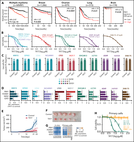 Selective targeting of chr1q-amp tumor cells with a selective PBX1 inhibitor. (A) Survival analysis of patients with MM or with breast, ovarian, lung, or brain cancer based on the PBX1 signature expression (red: high; black: low; n = 320 genes; supplemental Table 5). Kaplan-Meier plots and statistical analysis depict the significantly poorer survival of patients with an active PBX1 signature. (B) Cytotoxicity profiles (n = 3) of MM cells (MM.1S, OPM2, U266, NCU.MM1) and breast (MCF-7, LTED), ovarian (OVCAR-3, A2780), lung (A549, H69AR), and brain (SNB-75) cancer cell lines 48 hours after treatment with the small molecule PBX1 inhibitor T417. Three independent experiments were performed per cell line, and 50% inhibitory concentration (IC50) values were calculated using a nonlinear fitting model (fitting line represented here). (C) Cell cycle profiling of 11 cancer cell lines 48 hours after treatment with 1% DMSO (control) or T417 (20 μM). Three independent experiments were performed per cell line. Statistical comparisons were performed using a 2-way nonparametric analysis of variance (ANOVA) with a post hoc multiple-comparisons test. (D) Assessment of PBX1, FOXM1, NEK2, and E2F2 mRNA levels in 11 cancer cell lines 16 to 20 hours after treatment with 1% DMSO (control) or T417 (20 μM). Bar graphs illustrate transcriptional levels normalized to corresponding control samples (n = 3 replicates). Analysis was performed using a paired Student t test. (E) Tumor volumes of MM.1S xenografts measured in vehicle-treated (control) and T417-treated (10 mg/kg per injection) mice across experimental time points. Statistical analysis was performed using a 2-way ANOVA with a post hoc multiple-comparisons test. (F) Tumors explanted from control- and T417-treated mice at the termination of the study (day 23). (G) Heat map representation of PBX1, FOXM1, NEK2, and E2F2 mRNA levels assessed by RT-qPCR. For the in vivo experiment in tumor explanted cells, values represent pairwise comparisons of the T417 group (D1-D5) against the vehicle-treated group (C1-C5). For in vitro primary myeloma PC samples, values represent T417-treated (20 μM) vs control-treated (1% DMSO) cells. Gray boxes correspond to nonapplicable comparisons resulting from undetectable levels of mRNA in control-treated cells. (H) Cell viability of primary chr1q-amp MM (X1, X2, X3; green), nonamplified MM (X4, X5; orange), and normal donor PBBCs (orange) at 48 hours after treatment with 1% DMSO (control) or T417 (20 μM). Nonlinear data fitting and IC50 calculations were performed as described in (B). *P < .05; **P < .01; ***P < .001; ****P < .0001. HR, hazard ratio; n/a, not applicable (noncalculable); Rel., relative; Undet., undetermined.