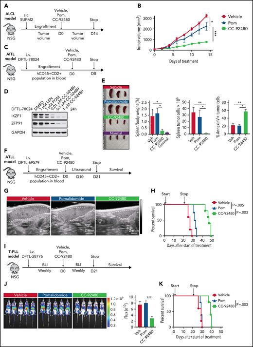 CC-92480 induces tumor regression and extends survival in TCL models in vivo. (A) Workflow of ALCL SUP-M2 in vivo model. (B) Tumor volume of mice treated with vehicle, 3 mg/kg pomalidomide (pom), or 1 mg/kg CC-92480 by mouth daily (n = 3 per arm). (C) Workflow of AITL model using DFTL-78024 PDX cells. (D) Western blot analysis of IKZF1 and ZFP91 expression in DFTL-78024 PDX cells upon exposure to lenalidomide (len), pom, or CC-92480 at indicated doses for 24 hours. (E) Spleens were harvested from mice treated with vehicle (n = 3), pom (3 mg/kg, n = 4), CC-92480 (1 mg/kg, n = 4), as well as from unengrafted NSG mice (normal, n = 3). Spleen/body weight, spleen tumor burden (the number of Annexin V-PI- tumor cells), and the percent of Annexin V+ tumor cells are shown on the right. Data are presented as mean plus or minus SEM. (F) Workflow of ATLL model using DFTL-69579 PDX cells. (G) Representative ultrasounds showing reduced spleen size (dotted border) after 10-day treatment with CC-92480. (H) Kaplan-Meier survival analyses by log-rank test after 21-day treatment with vehicle (n = 5), pom (3 mg/kg, n = 4), or CC-92480 (1 mg/kg, n = 5). (I) Workflow of T-cell prolymphocytic leukemia model using DFTL-28776 PDX cells that express a luciferase reporter. (J) Bioluminescence imaging of mice exposed to vehicle (n = 5), pomalidomide (3 mg/kg, n = 5), or CC-92480 (1 mg/kg, n = 5) for 21 days. (K) Kaplan-Meier survival analyses by log-rank test. Arrows indicate start (day 0) and stop (day 21) of treatment. *P < .05; **P < .01; ***P < .001. NSG, NOD scid gamma; SEM, standard error of the mean.