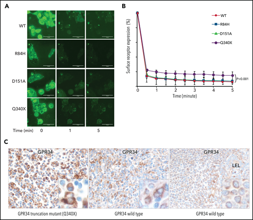 Ligand-induced GPR34 internalization is impaired by mutation. (A) Analysis of subcellular localization of GPR34 and its various mutants by using time-lapse microscopy. Isogenic Flp-InTRex293 cell lines that stably express a single copy of GPR34-GFP or its various mutants were treated with LysoPS (100 µM), and GPR34 expression was monitored over a 30-minute period. Shown is GPR34 expression at selected time points after ligand stimulation. The video record is presented in supplemental Figure 5. (B) The membrane expression in individual cells was quantified at the indicated time by using ImageJ software and normalized to the 0 time point. Comparison between wild-type (WT) GPR34 and its various mutants was performed with Prism 6 nonlinear regression analyses (GraphPad Software), with significant differences indicated. (C) GPR34 immunohistochemistry shows examples of strong (left), moderate (middle), and weak (right) staining.