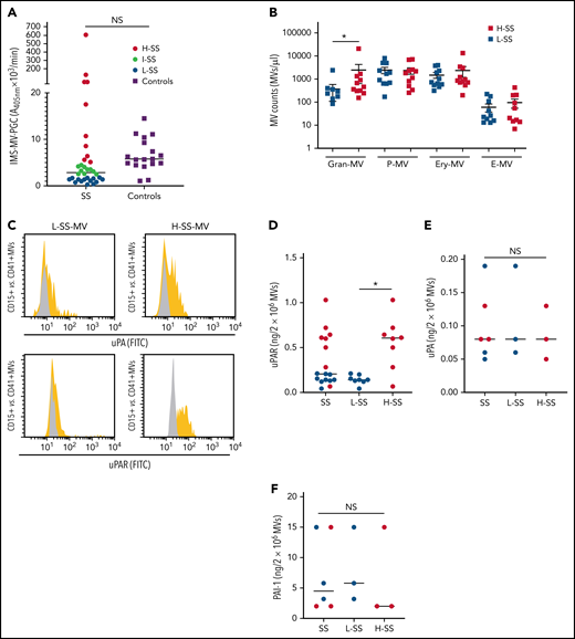Gran-MVs from SS patients display a heterogeneous profile of PGC driven by the uPA/uPAR system. (A) The microvesicle-dependent plasmin generation capacity (MV-PGC) of MVs isolated from SS patient platelet-free plasma, with a low MV-PGC (blue circle), an intermediate MV-PGC (green circle), and a high MV-PGC (red circle), compared with the MV-PGC of MVs isolated from healthy donor plasma (n = 18, purple square). Each patient and healthy control were evaluated in duplicate. (B) Counts of Gran-MVs (annV/CD15), P-MVs (annV/CD41), Ery-MVs (annV/CD235a), and E-MVs (annV/CD146) by flow cytometry in PFP from SS patients with low (<1.5 A405nm × 10−3/min, n = 12, blue square) or high (>5 A405nm × 10−3/min, n = 10; red square) MV-PGC values. Data are mean ± SEM. (C) Flow cytometric detection of uPA (upper graphs) and uPAR (lower graphs) on the surface of CD15+ MVs from SS patients with low (L-SS-MV) or high (H-SS-MV) PGC values (yellow traces). The expression of uPA or uPAR on CD41+ platelet-derived MV was used as a negative control (gray traces). (D-F) Detection by ELISA of uPAR, uPA, and PAI-1 on purified total MVs from SS patients (SS-MVs) divided into 2 groups: patients with low (<1.5 A405nm × 10−3/min, n = 11, L-SS-MV, blue circle) and high (>5 A405nm × 10−3/min, n = 11, H-SS-MV, red circle) MV-PGC values. *P < .05. annV: annexin V; NS: not significant.