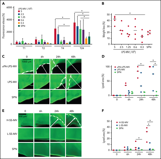 MVs from SS patients lyse a thrombus according to their MV-PGC level. (A-B) MVs purified from blood stimulated with LPS (LPS-MVs) lyse a fluorescent human thrombus suspended in plasma in a dose-dependent manner (5-0.3 × 106 MVs). Thrombolysis was monitored by measuring the fluorescence released in the thrombus supernatant at 1, 2, 4, and 24 hours (A) and the loss of thrombus weight after 48 hours (B). The results are expressed as the percentage of fluorescence increase and weight loss compared with their initial values at 0 (n = 5). (C-D) Thrombolysis mediated by LPS-MVs (107 MVs) in a lysis front retraction model. Lysis is amplified by the saturation of uPAR with exogenous uPA (uPA-LPS-MVs) on the MV surface. Representative fluorescence microscopy images (C) display the retraction of the lysis front (white arrows) at 0, 6h, 24h, and 48 hours; black bar = 1000 µm. The lysis area (D) was calculated considering the whole thrombus surface (4.3 mm2) using ImageJ software. uPA-LPS-MV: red circle; LPS-MV: blue circle; and SPN: green circle. (E-F) Thrombolysis mediated by MVs from SS patients in a lysis front retraction model. Representative fluorescence microscopy images (E) display thrombolysis in the presence of SS-MVs (2 × 107 MVs) purified from a pool of SS patients with low (<1.5 A405nm × 10−3/min, L-SS-MV: blue circle) or high (>5 A405nm × 10−3/min, H-SS-MV: red circle) MV-PGC; n = 3. For each experiment, the negative control was represented by the last MV wash supernatant (SPN: green circle). Black bar = 500 µm. The lysis area (F) was calculated considering the whole thrombus surface (4.3 mm2) using ImageJ software. Low-SS-PGC: blue circle; high-SS-PGC: red circle; and SPN: green circle. *P < .05