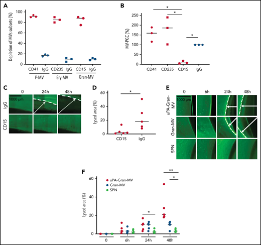 Gran-MVs are the MV subset that mediates the thrombolytic activity. (A) Flow cytometric monitoring of MVs after selective depletion of MV subsets: platelet-derived MVs (P-MVs), erythrocyte-derived MVs (ery-MVs), and granulocyte-derived MVs (Gran-MVs). Immunomagnetic separation was performed using beads coated either with CD41 (red circle), CD235a (red square), or CD15 (red rhombus). Negative control experiments were performed in parallel using beads coated with an irrelevant antibody (IgG, blue symbols); n = 3. (B) The MV-PGC test was performed on MVs after the selective depletion of CD41+, CD235a+, or CD15+ MV subpopulations or after a control IMS (IgG); n = 3, CD41: red circle; CD235a: red square; CD15: red rhombus; IgG: blue circle. (C) The thrombolytic effect of MVs depleted of CD15-MVs or those subjected to a control IMS depletion (IgG) was evaluated in the lysis front retraction model at 0, 24h, and 48 hours in the presence of 107 MVs. (D) The lysis area was calculated at 48 hours, considering the entire thrombus surface (4.3 mm2), using ImageJ software. *P < .05; **P < .01. (E-F) Thrombolysis mediated by Gran-MVs (5 × 106 MVs) in a lysis front retraction model. Lysis is amplified by the saturation of uPAR with exogenous uPA (uPA-Gran-MVs) on the MV surface. Representative fluorescence microscopy images (E) display the retraction of the lysis front (white arrows) at 0, 6, 24h, and 48 hours; black bar = 1000 µm. The lysis area (F) was calculated considering the whole thrombus surface (150 mm2) using ImageJ software; uPA-Gran-MV: red circle; Gran-MV: blue circle; SPN: green circle; n = 5. *P < .05; **P<.01