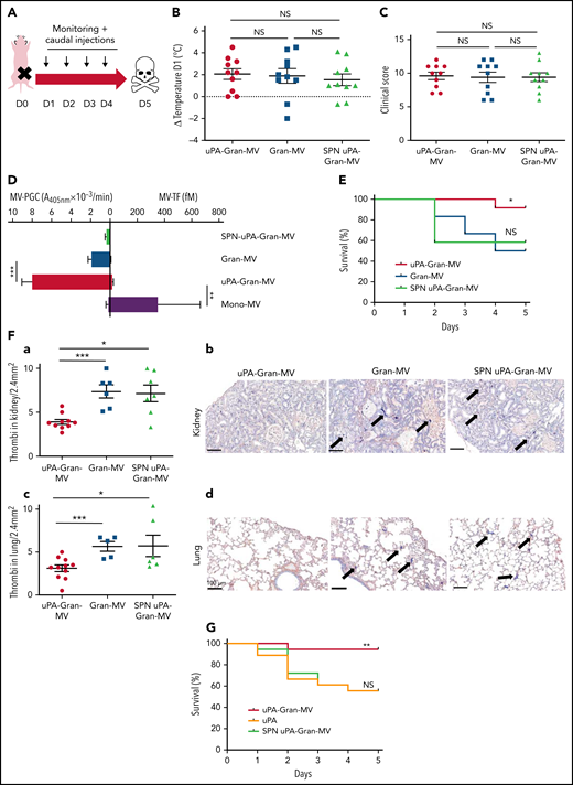 Injection of MVs with a high level of PGC improves survival and reduces clot formation in a murine model of sepsis. (A) Cecal ligation was performed on CD-1 mice (n = 36 animals). Each group of animals received a daily IV tail injection (D1 to D4) of uPA-Gran-MVs or Gran-MVs or SPN uPA-Gran-MVs from D1 (24 hours after surgery). Once sepsis was established, mice were observed daily to assess spontaneous mortality and monitored to measure their heart rate, oxygen saturation, breathing rate, and body temperature. The animals were sacrificed at D5. (B-C) Temperature amplitude at D1 (°C) and the clinical score of 3 groups of animals injected with uPA-Gran-MVs (red circle), Gran-MVs (blue square), or SPN uPA-Gran-MVs (green triangle) (n = 12 animals per group). Data are mean ± SEM. (D) Coagulolytic balance (MV-PGC and MV-TF) of uPA-Gran-MVs (107) (red), Gran-MVs (107) (blue), supernatant (SPN-uPA-Gran-MVs) (green), and Mono-MVs (107) (purple); n = 3. (E) Survival curve of animals (n = 12 in each group). The results are presented as the percent survival. (Fa,c) Count of microthrombi in kidney and lung tissues after hematoxylin-eosin and phosphotungstic acid-hematoxylin staining (PTAH; uPA-Gran-MVs n = 10, red circle; Gran-MVs n = 6, blue square; SPN uPA-Gran-MVs n = 7, green triangle). Data are mean ± SEM. (Fb,d) Histopathology of lung and kidney tissue samples from different groups of mice. Injected with uPA-Gran-MVs (n = 11); injected with Gran-MVs (n = 6); control group injected with SPN uPA-Gran-MVs (n = 6). Microthrombi are indicated by black arrows; black bar = 100 µm. (G) Survival curve of animals injected in uPA-Gran-MVs (107) (red), soluble uPA (orange), or SPN-uPA-Gran-MVs (green) (n = 12 in each group). The results are presented as the percent survival. *P < .05; **P < .01; ***P < .001; NS: not significant.
