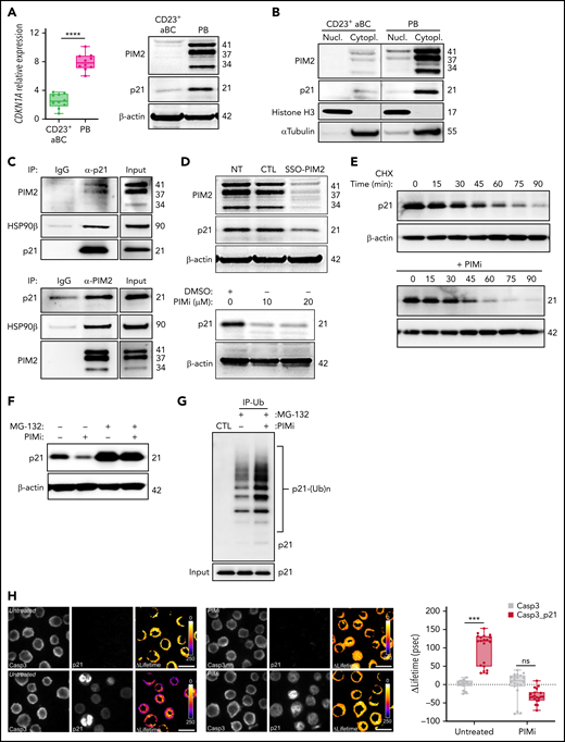 PIM2 helps to stabilize cytoplasmic p21Cip1 and promotes the caspase 3/p21Cip1 interaction. (A) Left: CDKN1A mRNA expression was measured on D6 in CD23+ aBCs and PBs. Data are presented as the median (range), n = 10. Right: PIM2 and p21Cip1 protein expression on D6 in CD23+ aBCs and PBs. (B) PIM2 and p21Cip1 protein expression was measured in nuclear and cytoplasmic fractions from CD23+ aBCs and PBs. (C) PIM2 (left) and p21Cip1 (right) immunoprecipitation (IP) in PBs. Heat shock protein 90β (HSP90β), p21Cip, and PIM2 were detected by immunoblotting. (D) PIM2 and p21Cip1 protein expression after treatment with SSO-PIM2 (top) or PIMi (bottom) in total extracts from PBs. (E) PBs were sorted and then treated with PIMi and incubated with cycloheximide (CHX). At indicated times, p21Cip1 expression was assessed by immunoblotting. (F) PBs were sorted and then treated with PIMi for 2 hours in the presence (or not) of MG-132. p21Cip1 was assessed by immunoblotting. (G) PBs were treated for 30 minutes with PIMi after incubation in the presence of MG-132 for 2 hours. Polyubiquitinated p21Cip1 and native p21Cip1 were assessed by immunoblotting. (H) FRET/FLIM (Förster resonance energy transfer (FRET) by fluorescence lifetime imaging (FLIM)) was analyzed in XG21 cells stained for caspase 3 (the donor) in the presence or absence of p21Cip1 (the acceptor). Cells were left untreated (upper panels) or treated with PIMi (lower panels). The graph shows the quantified ΔLifetime. Data are presented as the median (range), n = 20 cells per condition. Pseudocolor scale, pixel-by-pixel ΔLifetime. Scale bar: 10 µm. (I) p21Cip1 (top) and caspase 3 (bottom) IP in PBs. Caspase 3 and p21Cip were detected by immunoblotting. (J) p21Cip1, procaspase 3, cleaved caspase 3, and cleaved PARP protein expression on D6 in PBs, after transfection with siCDKN1A or siCTL on D4. (K) On D4, activated B cells were treated for 24 hours with increased doses of p21i in the presence or absence of Q-DEVD-OPH. PB viability (the proportion of active caspase 3–negative cells) was assessed by flow cytometry. Data are presented as the mean ± SD, n = 5. (L) The PIM2/p21Cip1/caspase 3 pathway in PBs. p21Cip1 is stabilized in the cytoplasm by a protein complex that also includes PIM2 and HSP90β. Due to this localization, p21Cip1 interacts with procaspase 3 and blocks its activation. Statistical significance was evaluated by using Mann-Whitney U (panels A and H) and Kruskal-Wallis (panel K) tests. *P < .05, ***P < .001, ****P < .0001. Cl, cleaved; DMSO, dimethyl sulfoxide; IgG, immunoglobulin G; IP-Ub, immunoprecipitation of ubiquitin forms; ns, not significant; NT, no treatment; siCTL, small interference (si) RNA control (CTL). Further details are presented in supplemental Figure 5.