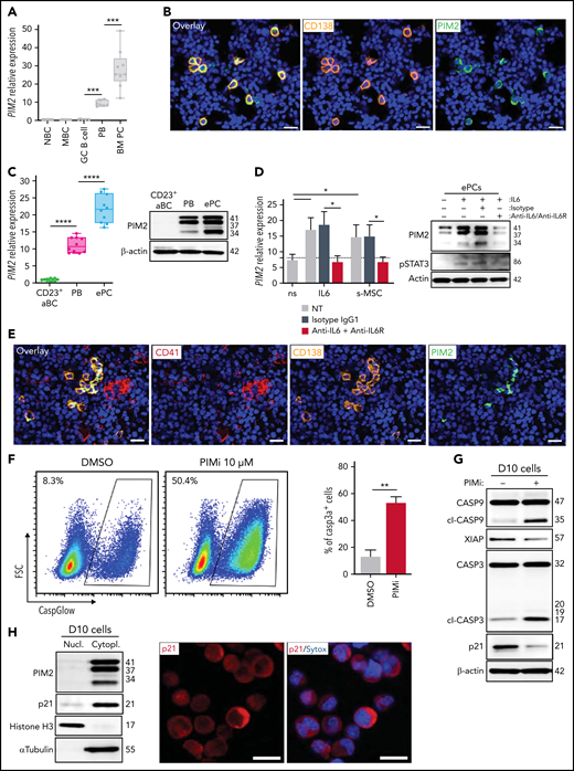 PIM2 in BM plasma cells. (A) PIM2 mRNA expression in different tonsil-derived B-cell populations (n = 7) and in BM PCs (n = 9). The data are presented as the median (range). (B) Immunofluorescence staining of PIM2 (green) and CD138 (orange) on paraffin-embedded normal BM. 4′,6-Diamidino-2-phenylindole (blue) stains the nucleus. Scale bar: 20 µm. (C) PIM2 mRNA and PIM2 protein expression in CD23+ aBCs and PBs on D6 and ePCs on day 10 (D10). Data are presented as the median (range), n = 10. (D) On D10, ePCs were sorted, starved, and treated (or not) with an anti–IL6R monoclonal antibody 1 hour before stimulation. IL-6 and supernatants of BM mesenchymal stroma cells (s-MSC) were pre-incubated (or not) for 1 hour with an anti-IL6 monoclonal antibody. PIM2 mRNA expression (left) and protein expression (right) in ePCs 5 hours after the addition of IL-6 or s-MSC. Data are presented as the mean ± SD, n = 4. (E) Immunofluorescence staining of PIM2 (green), CD41 (red), and CD138 (orange) on paraffin-embedded normal BM. 4′,6-Diamidino-2-phenylindole (blue) stains the nucleus. Scale bar: 20 µm. (F) On day 9, cells were treated with PIMi. The proportion of active caspase-3–positive cells was assessed on D10 by using flow cytometry. Data are presented as the mean ± SD, n = 6. (G) On D10, live cells were treated for 2 hours with PIMi. Protein expression levels of caspase 9, XIAP, caspase 3, and p21Cip were assessed by immunoblotting. (H) p21Cip1 expression was assessed on D10 in nuclear and cytoplasmic fractions by immunoblotting and immunofluorescence. Sytox (blue) stains the nucleus. Scale bar: 5 µm. (I) FRET/FLIM data were analyzed for ePCs stained for (the donor) PIM2 (left) or caspase 3 (right) in the presence or absence of p21Cip1 (the acceptor). The graph shows the quantified ΔLifetime. Data are presented as the median (range), n = 20 cells per condition. Pseudocolor scale, pixel-by-pixel ΔLifetime. Scale bar: 10 µm. Statistical significance was evaluated by using the Mann-Whitney U test in panels A, C, D, F, and I. *P < .05, **P < .01, ***P < .001, ****P < .0001. DMSO, dimethyl sulfoxide; FRET/FLIM, förster resonance energy transfer (FRET) by fluorescence lifetime imaging (FLIM)FSC, forward scatter; GC, germinal center; MBC, memory B cells; NBC, naive B cells; ns, not significant; NT, no treatment. Further details are presented in supplemental Figure 6.