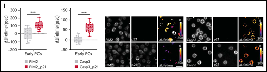 PIM2 in BM plasma cells. (A) PIM2 mRNA expression in different tonsil-derived B-cell populations (n = 7) and in BM PCs (n = 9). The data are presented as the median (range). (B) Immunofluorescence staining of PIM2 (green) and CD138 (orange) on paraffin-embedded normal BM. 4′,6-Diamidino-2-phenylindole (blue) stains the nucleus. Scale bar: 20 µm. (C) PIM2 mRNA and PIM2 protein expression in CD23+ aBCs and PBs on D6 and ePCs on day 10 (D10). Data are presented as the median (range), n = 10. (D) On D10, ePCs were sorted, starved, and treated (or not) with an anti–IL6R monoclonal antibody 1 hour before stimulation. IL-6 and supernatants of BM mesenchymal stroma cells (s-MSC) were pre-incubated (or not) for 1 hour with an anti-IL6 monoclonal antibody. PIM2 mRNA expression (left) and protein expression (right) in ePCs 5 hours after the addition of IL-6 or s-MSC. Data are presented as the mean ± SD, n = 4. (E) Immunofluorescence staining of PIM2 (green), CD41 (red), and CD138 (orange) on paraffin-embedded normal BM. 4′,6-Diamidino-2-phenylindole (blue) stains the nucleus. Scale bar: 20 µm. (F) On day 9, cells were treated with PIMi. The proportion of active caspase-3–positive cells was assessed on D10 by using flow cytometry. Data are presented as the mean ± SD, n = 6. (G) On D10, live cells were treated for 2 hours with PIMi. Protein expression levels of caspase 9, XIAP, caspase 3, and p21Cip were assessed by immunoblotting. (H) p21Cip1 expression was assessed on D10 in nuclear and cytoplasmic fractions by immunoblotting and immunofluorescence. Sytox (blue) stains the nucleus. Scale bar: 5 µm. (I) FRET/FLIM data were analyzed for ePCs stained for (the donor) PIM2 (left) or caspase 3 (right) in the presence or absence of p21Cip1 (the acceptor). The graph shows the quantified ΔLifetime. Data are presented as the median (range), n = 20 cells per condition. Pseudocolor scale, pixel-by-pixel ΔLifetime. Scale bar: 10 µm. Statistical significance was evaluated by using the Mann-Whitney U test in panels A, C, D, F, and I. *P < .05, **P < .01, ***P < .001, ****P < .0001. DMSO, dimethyl sulfoxide; FRET/FLIM, förster resonance energy transfer (FRET) by fluorescence lifetime imaging (FLIM)FSC, forward scatter; GC, germinal center; MBC, memory B cells; NBC, naive B cells; ns, not significant; NT, no treatment. Further details are presented in supplemental Figure 6.