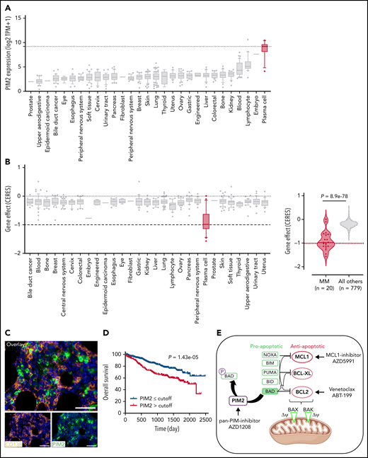Reconsideration of PIM2 as an effective target in MM. (A) PIM2 gene expression in cell lines derived from various solid and blood cancers (https://depmap.org/portal/). (B) CRISPR screening data from the DepMap Project show that PIM2 presents the highest dependency score for the 20 tested MM cell lines, relative to other cell lines. (C) Immunohistofluorescence staining of PIM2 (green) and CD138 (orange) in paraffin-embedded BM from patients with MM. 4′,6-diamidino-2-phenylindole (blue) stains the nucleus. Scale bars: 20 µm (top); 50 µm (bottom). (D) Overall survival of patients from the CoMMpass cohort as a function of PIM2 expression (PIM-high group, n = 539; PIM-low group, n = 227). The expression cutoff was determined by applying the MaxStat package (cutoff = 313.02). (E) Effects of BH3 mimetics and PIMi on apoptosis. BH3 mimetics (eg, MCL1i, venetoclax) inhibit the binding of antiapoptotic molecules (MCL1 and BCL2, respectively) to the pro-apoptotic effectors BAK and BAX; this leads to mitochondrial depolarization and, ultimately, cell apoptosis. PIMi enhances the action of BAD: BAD binds to BCL2 and BCL-XL and therefore acts independently of MCL1i. The combination of these 2 compounds might result in greater activation of BAX and BAK and may increase the likelihood of cell death. (F-G) Left: The results of a cell viability assay and a synergy analysis after treatment with increasing concentrations of AZD1208 (PIMi) and AZD5991 (MCL1i) in XG7 cells (F) and U266 cells (G). Right: Flow cytometry assessment of apoptosis using 4′,6-diamidino-2-phenylindole (DAPI)/CaspGlow staining and immunoblotting for the detection of caspase 3 and PARP cleavage, after treatment of XG7 cells (panel F) and U266 cells (panel G) with selected doses of inhibitors. The bar plot shows the percentage of caspase 3–active positive cells. Data are presented as the mean ± SD, n = 5. (H) Flow cytometry assessment of viability for primary cells from 6 patients with MM. The bar plot shows the percentage of viable CD138+ MM cells and CD138– cells, relative to a control (set to 100%) after treatment with the selected doses of inhibitor. Statistical significance was evaluated by using the Mann-Whitney U test in panels F, G, and H. **P < .01. See also supplemental Figure 7.