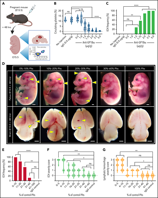 Defining the thrombocytopenic threshold for in utero ICH. (A) Experimental plan. E13.5 pregnant mice were injected with anti-GP1Bα antibody at a series of concentrations and analyzed 48 hours after injection for platelet numbers and hemorrhage phenotype. IgG antibody at 5 µg/g was used as a control. (B) Frequency of circulating platelets in the peripheral blood in E13.5 + 48 hours (E15.5) fetuses. No injection control: n = 7; IgG: 5 µg/g, n = 16; anti-GP1Bα: 0.5 µg/g, n = 15; 1.0 µg/g, n = 6; 1.5 µg/g, n = 14; 1.75 µg/g, n = 14; 2.0 µg/g, n = 18; 2.5 µg/g, n = 15; 5.0 µg/g, n = 15. ****P < .0001. (C) ICH frequency at 48 hours after no injection control: n = 7; IgG: 5 µg/g, n = 16; anti-GP1Bα: 0.5 µg/g, n = 15; 1.0 µg/g, n = 6; 1.5 µg/g, n = 14; 1.75 µg/g, n = 14; 2.0 µg/g, n = 18; 2.5 µg/g, n = 15; 5.0 µg/g, n = 15. **P = .002; ****P = .000007. (D) Representative images of E13.5 + 48 hours (E15.5) fetuses and dissected brains after treatment with IgG control or anti-GP1Bα antibody. Fetuses were classified according to the percentage of normal platelet count. Images shown represent the most frequent severity of hemorrhage observed in each group (scale bars represent 1 mm). (E) Frequency of ICH at platelet counts: 0% to 10%, n = 13; 11% to 20%, n = 17; 21% to 30%, n = 12; 31% to 60%, n = 8; 100%, n = 14; IgG control: n = 14. **P = .004; ****P < .00001. (F) ICH severity scores at platelet counts: 5% to 10%, n = 10; 11% to 15%, n = 6; 16% to 20%, n = 5; 21% to 25%, n = 5; 31% to 40%, n = 3; 41% to 60%, n = 8; 100% IgG: n = 8. Arbitrary values were used to define 3 as severe ICH (intraventricular involvement and/or the presence of large cortical hemorrhage), 2 as moderate ICH (large focal hemorrhage), 1 as mild ICH (small focal hemorrhage), and 0 as no ICH. *P = .05; **P < .001; ***P = .0006. (G) Lymphatic bleed severity scores: 0% to 5%, n = 8; platelet counts: 6% to 10%, n = 11; 11% to 15%, n = 6; 16% to 20%, n = 5; 21% to 25%, n = 4; 31% to 40%, n = 2; 41% to 60%, n = 8; 100% IgG: n = 8. Arbitrary values were used to define 3 as severe hemorrhage (edema, dermal hemorrhage, and extensive blood-filled lymphatics), 2 as moderate hemorrhage (extensive blood-filled lymphatics), 1 as mild hemorrhage (blood-filled lymphatics or focal dermal hemorrhage), and 0 as no hemorrhage. *P < .05; **P = .005. Data were analyzed with one-way analysis of variance (ANOVA) using the Šídák multiple comparisons test (B), or by using contingency table analysis with Fisher’s exact test (C,E-G). P values were adjusted for multiple testing using the Holm-Šídák method (C,E-G). ns, not statistically significant; Plts, platelets.
