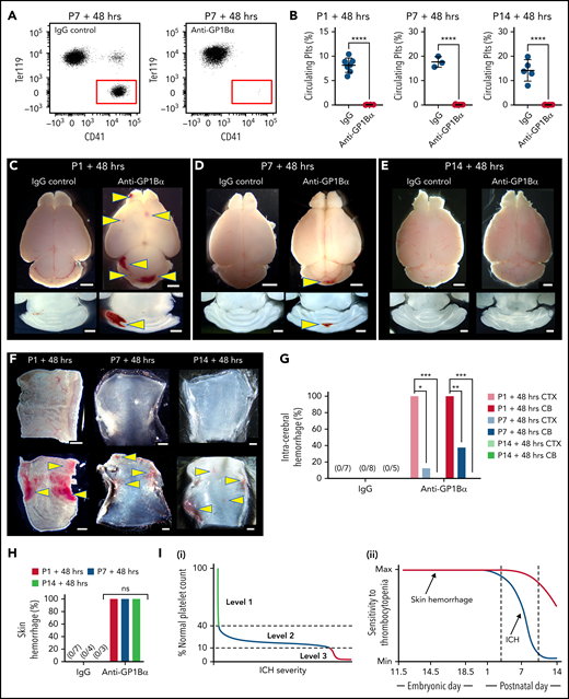 Sensitivity of the cerebral vasculature to induced thrombocytopenia ends within the first weeks after birth. (A) Representative flow cytometry plots of platelets in the peripheral blood of P7 mice 48 hours after treatment with IgG or anti-GP1Bα antibody. (B) Quantification of circulating platelets 48 hours after treatment with IgG or anti-GP1Bα antibody on P1, P7, or P14. P1: IgG control, n = 7; anti-GP1Bα, n = 6. P7: IgG control, n = 3; anti-GP1Bα, n = 11. P14: IgG control, n = 5; anti-GP1Bα, n = 9. Error bars represent mean ± standard deviation. ****P < .0001. (C-E) Representative images of brain and horizontal sections of the cerebellum 48 hours after injection at (C) P1, (D) P7, and (E) P14. P1: IgG control, n = 8; anti-GP1Bα, n = 8. P7: IgG control, n = 6; anti-GP1Bα, n = 14. P14: IgG control, n = 6; anti-GP1Bα, n = 15. Arrows indicate sites of ICH. Scale bars represent 1 mm. (F) Representative images of the dermal skin layer showing hemorrhage (arrows) 48 hours after injection at P1 (IgG, n = 7; anti-GP1Bα, n = 10), P7 (IgG, n = 4; anti-GP1Bα, n = 4), and P14 (IgG, n = 3; anti-GP1Bα, n = 7). (G) Frequency of hemorrhage in the cerebral cortex (CTX) and cerebellum (CB) 48 hours after antibody injection at P1 (IgG, n = 7; anti-GP1Bα, n = 10), P7 (IgG, n = 8; anti-GP1Bα, n = 8), and P14 (IgG, n = 5; anti-GP1Bα, n = 8). *P = .02; **P = .001; ***P = .0001. (H) Frequency of skin hemorrhage at P1, P7, and P14 at 48 hours after injection. (I) Summary schematics illustrating (i) identification of 3 levels of in utero thrombocytopenia that confer increasing risk of ICH and hemorrhage severity; (ii) the development of resilience to thrombocytopenia-induced ICH within the first 2 weeks after birth. Data were analyzed using the unpaired two-tail Student t test (B) or by using contingency table analysis with Fisher’s exact test (G-H). P values were adjusted for multiple testing using the Holm-Šídák method (G-H).
