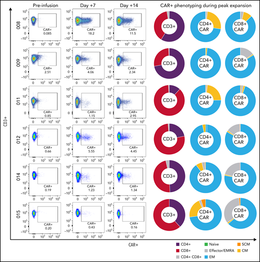 Peripheral CAR-T expansion and phenotyping. Expansion of tisagenlecleucel in peripheral blood and associated CAR-T phenotyping during peak expansion (day +7) demonstrating variable TNaïve, TEMRA, TEM, TCM, and TSCM phenotypes.