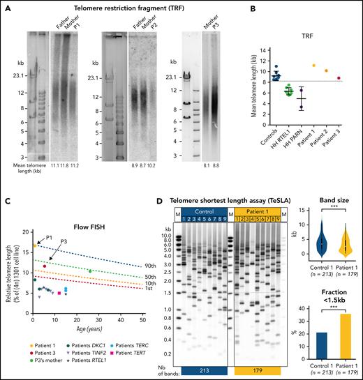 Telomere length in blood cells from patients. (A) Telomere length determined by telomere restriction fragment (TRF) assay in DNA from blood cells from patients P1, P2, P3 and their parents (P3′s father's sample was not available). (B) Graphic representation of TRF data obtained in panel A as well as in 8 age-matched controls, 8 RTEL1-deficient patients, and 2 PARN-deficient patients described elsewhere.31-34 (C) Relative telomere length in comparison with the tetraploid control cell line (1301) measured by Flow-FISH in blood cells from P1, P3, P3′s mother and 13 DC/HH patients with pathogenic variants in DKC1, TERT, TERC, RTEL1, or TINF2. Lines represent the 1st, 10th, 50th and 90th percentiles of telomere length of healthy controls. (D) (Left) Detection of the shortest telomeres by TeSLA performed in blood cells from P1 and an age-matched healthy donor. (Right) Graphic representation of TeSLA data with statistical analyses reveals a significant increase in telomere loss events in P1's blood sample. A 2-tailed Student t-test was used for statistical analyses of band size and a χ2 test was used for analysis of fraction < 1.5kb.