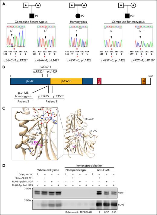 Genetic analysis identified Apollo variants in the patients. (A) Pedigrees and Apollo variants identified in individuals P1, P2 and P3 by Sanger sequencing. (B) Domain architecture of the human Apollo with the localization of the identified variants of P1, P2 and P3. NLS: nuclear localization signal; TBM: TRFH binding motif. (C) Ribbon representation of the 3D structure of human Apollo catalytic domain (pdb 5AHO,39 with 2 coordinated zinc ions and 2 tartrate molecules at the active site. Details of the region surrounding L142 are given in the box at left, highlighting the hydrophobic core in which L142 participates, in the vicinity of motif A D145 (bond with motif B H247, itself bound to a tartrate molecule, which may represent the phosphodiester cleaved by the nuclease39). (D) Co-immunoprecipitation of endogenous TRF2 with WT or mutated forms of FLAG-Apollo. Picture representative of 3 independent experiments.
