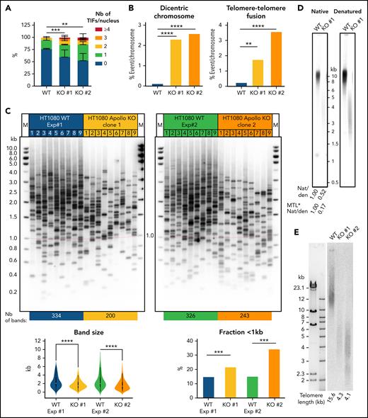Telomere defects in HT1080 Apollo KO cell lines. (A) Quantitative analysis of TIFs in the 2 HT1080 Apollo KO clones and WT cells. (WT: n = 88, KO #1: n = 55; KO #2: n = 66). (B) Quantitative analysis of telomeric aberrations detected by FISH. Percentage of events per chromosomes (counted chromosomes: WT: n = 715; KO #1: n = 887; KO #2: n = 528). Averages and χ2 tests were applied to compare Ctl with either P1 or P2. (C) (Top) Detection of the shortest telomeres by TeSLA performed in WT HT1080 cell line and in the 2 Apollo KO HT1080 cell lines #1 and #2. (Bottom) Graphic representation of TeSLA data with statistical analyses. A 2-tailed student t-test was used for statistical analyses of band size and a χ2 test was used for analysis of fraction < 1kb. (D) Measurement of G-overhang signal by native (Nat) versus denatured (den) in-gel hybridization method with C-rich telomeric probe in WT and Apollo KO #1 HT1080 cell lines. The value of the 3′ overhang was normalized to the control. Values after correction for the effect of the telomere length are also indicated (noted MTL*Nat/den). (E) Telomere length determined by telomere restriction fragment (TRF) assay with DNA from the WT and the Apollo KO HT1080 cell lines #1 and #2. **P < .01, ***P < .001, ****P < .0001.