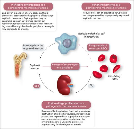 A schematic representation of the human erythron (erythroid marrow plus circulating RBCs), the kidney oxygen-sensing apparatus, and the reticuloendothelial system that phagocytizes senescent RBCs and returns iron to the erythroid marrow. Erythroid hypoproliferation, ineffective erythropoiesis, and peripheral hemolysis are the 3 major categories of a functional classification of anemia. Professional illustration by Somersault18:24.