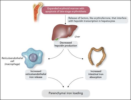 Schematic representation of the molecular mechanisms that lead to parenchymal iron loading in inherited anemias associated with ineffective erythropoiesis, the so-called “iron-loading anemias.” The most representative iron-loading anemias are nontransfusion-dependent β-thalassemia, inherited sideroblastic anemias, and congenital dyserythropoietic anemias. Professional illustration by Somersault18:24.