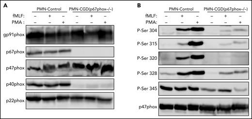 Phosphorylation of p47phox in neutrophils from p67phox-deficient patients and from healthy donors. (A) Neutrophils from healthy donors (PMN-Control) and p67phox-deficient patients (PMN-CGD(p67−/−)) (15 × 106/400 µL) were incubated with fMLF (1 µM) or PMA (200 ng/mL) for 10 seconds and 10 minutes, respectively, and the reaction was stopped by denaturation with 100 µL hot Laemmli sample buffer (5×). Homogenates were subjected to SDS-PAGE and western blotting using anti-gp91phox, anti-p67phox, anti-p47phox, anti-p40phox, and anti-p22phox antibodies. (B) Neutrophils from healthy donors (PMN-Control) and p67phox-deficient patients (PMN-CGD(p67−/−)) (15 × 106/400 µL) were incubated with fMLF (1 µM) or PMA (200 ng/mL) for 10 seconds and 10 minutes, respectively, and the reaction was stopped by denaturation with 100 µL hot Laemmli sample buffer (5×). Homogenates were subjected to SDS-PAGE and western blotting using different anti-phospho-p47phox antibodies: anti-phospho-Ser304, anti-phospho-Ser315, anti-phospho-Ser320, anti-phospho-Ser328, and anti-phospho-Ser-345 antibodies and anti-p47phox antibody. Experiments were repeated twice in duplicates.