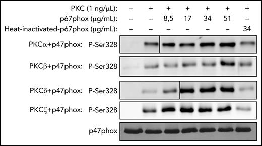 Concentration-dependent effect of p67phox on p47phox phosphorylation by PKC isoforms in vitro and effect of denatured p67phox. Recombinant p47phox protein was incubated without or with different concentrations of p67phox or with heat-denatured p67phox for 10 minutes; PKCα, PKCβ, PKCδ, or PKCζ was added, incubated for 5 minutes, and the reaction was started by adding ATP, followed by incubation at 30°C for 15 minutes. The reactions were terminated by the addition of 5× Laemmli sample buffer and denaturation at 100°C. Proteins were subjected to SDS-PAGE and western blotting using various anti-phospho-p47phox antibodies. Results with anti-phospho-Ser328 antibody are shown. Experiments were repeated 3 times.
