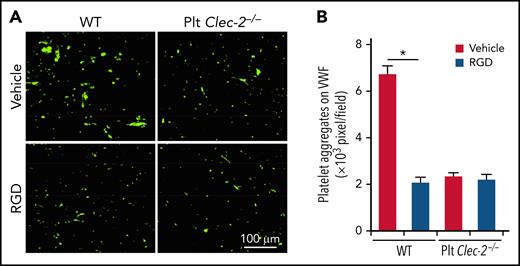 CLEC-2 deficiency impairs platelet aggregation on immobilized VWF under flow. Washed platelets treated with albumin or 20 μg/mL of RGD, an integrin αIIbβ3 antagonist, were perfused over immobilized plasma VWF (150 μg/mL) at 10 dyne/cm2 for 10 minutes. After removing nonadherent platelets, adhered platelets were fixed with 2% paraformaldehyde (PFA), stained with anti-CD41 antibodies, and observed with microscopy. (A) Representative images of platelet aggregation on immobilized VWF under flow. (B) Quantification of platelet aggregation on immobilized VWF under flow. Adherent platelets described in (A) were quantified by analyzing the pixels of CD41-positive areas in each field. The data are representative of 5 independent experiments, and data represent mean ± SD. *P < .05.