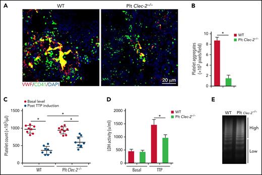 Platelet CLEC-2 deficiency protects mice from thrombotic injury in a mouse model of TTP. Mice were injected with antibodies to ADAMTS13 and human plasma VWF to induce TTP. At 24 hours after TTP induction, blood was collected to analyze VWF levels and platelet count, and lungs were collected to analyze thrombus formation. (A) Representative immunofluorescence images of thrombi in lungs of mice with TTP. (B) Quantification of thrombus formation in lung shown in (A). Quantification of the pixels of CD41-positive areas in each field of images. (C) Platelet counts in mice with TTP. Platelet counts in mice at 7 days before experiments (basal level) and at 24 hours after induction of TTP (by injecting antibodies to ADAMTS13 and VWF) were quantified. Each dot represented a datum from 1 mouse. Comparisons marked by asterisks are significantly different (P < .05). (D) Blood LDH activity of mice at basal level and at 24 hours after TTP induction. (E) Analysis of VWF in blood of mice with TTP by electrophoresis on agarose gel and by densitometric scanning. The data are representative of 5 independent experiments, and data represent mean ± SD. *P < .05.