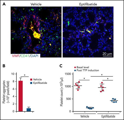Inhibition of integrin αIIbβ3 activation reduces thrombus formation in TTP. WT mice were injected with antibodies to ADAMTS13 and human plasma VWF to induce TTP. At 24 hours after TTP induction, blood was collected to analyze platelet count, and lungs were collected to analyze thrombus formation. Saline control or eptifibatide (15 mg/kg, body weight) was injected when VWF was administrated and then was given every 6 hours after the first administration. (A) Representative immunofluorescence images of thrombi in lungs of saline- and eptifibatide-treated mice with TTP. (B) Quantification of thrombus formation in lung shown in (A). Quantification of the pixels of CD41-positive areas in each field of images. (C) Platelet counts in mice with TTP. Platelet counts in mice at 7 days before experiments (basal level) and at 24 hours after induction of TTP were quantified. Each dot represented a datum from 1 mouse. The data are representative of 5 independent experiments, and data represent mean ± SD. *P < .05.