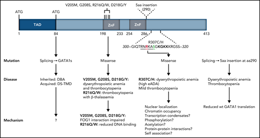 Structure of the human GATA1 protein. GATA1 mutations found in patients with congenital red blood cell disorders and thrombocytopenias are indicated, with their clinical manifestation and the possible molecular mechanisms underpinning them.1,9,10 TAD, N-terminal activation domain deleted by missense mutations resulting in expression of GATA1short associated with DBA and transient myeloproliferative disease in Down syndrome. Amino acids 300 to 320 located C-terminally to the second DNA binding ZF are shown, with R307 shown in red and phosphorylatable S310 shown in green. The AKT phosphorylation consensus sequence is underlined. The acetylatable lysine cluster is shown in bold. Amino acids 300 to 320 largely overlap the IDR described by Ludwig et al. aa, amino acids; DBA, Diamond-Blackfan anemia; DS-TMD, transient myeloproliferative disease associated with Down syndrome.
