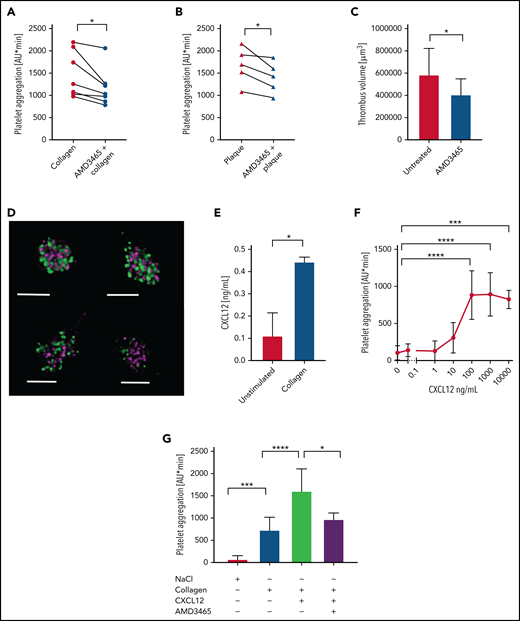 The CXCL12–CXCR4 axis functions as a positive feedback loop in human platelet activation. Platelet aggregation was assessed by MEA in human blood activated by collagen (0.2 μg/mL) (A) or human plaque homogenate (B). CXCR4 was inhibited by 100 nM AMD3465 (n = 5-8). (C) Thrombus formation was induced by perfusion (600 s−1) of human blood, preincubated with PBS or 1 μM AMD3465, in a plaque-coated flow chamber and thrombus volume determined by confocal microscopy (n = 7). (D) CXCL12 was visualized in resting human platelets that were permeabilized and double-stained with antibodies against CXCL12 (purple) and CXCL4 antibody (green) by stimulated emission depletion (STED) microscopy (Leica SP8; scale bar, 2 μm). (E) CXCL12 release from isolated human platelets after activation with collagen (5 μg/mL) was determined by enzyme-linked immunosorbent assay (n = 3). (F-G) Platelet aggregation was assessed by MEA of human blood incubated with different concentrations of recombinant CXCL12 (n = 5-10) (F) or combinations of collagen (0.1 μg/mL), recombinant CXCL12 (0.1 μg/mL), and AMD3465 (100 nM) as indicated (n = 6-10) (G). Data represent mean ± standard deviation from the indicated numbers of independent experiments. *P ≤ .05, ***P ≤ .001, ****P ≤ .0001, as analyzed by paired t test (panels A and B), unpaired t test (panels C and E), and one-way analysis of variance with Tukey’s multiple comparison test (panels F and G). AU, arbitrary units.