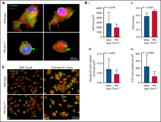 Impact of Grin1 deletion on platelet and MK spreading on either a collagen or fibrinogen matrix. (A-B) Morphology of MKs from Pf4-Grin1−/− and WT mice spread on glass coverslips coated with collagen. (A) Representative images of MKs stained for F-actin (red), α-tubulin (green), and Hoechst 33342 nuclear counterstain (blue). Red arrows indicate examples of F-actin nodules frequent in WT but not Pf4-Grin1−/− MKs. Green arrowheads point to the α-tubulin coil often maintained in Pf4-Grin1−/− MKs. (B) Bar graphs showing cell area (i), cell circularity (ii), F-actin nodule density per cell area (μm2) (iii), and numbers of F-actin nodules per cell (iv), quantified from fluorescence images shown in panel A using ImageJ. (C) Morphology of platelets from Pf4-Grin1−/− and WT mice spread on glass coverslips coated with fibrinogen. (C) Representative images of platelets activated with either 10 μM of ADP (i-ii) or 0.1 U/mL of thrombin (iii-iv) and stained for F-actin (red) and α-tubulin (green); red arrows point to F-actin nodules common in WT but not Pf4-Grin1−/− platelets (i-ii); green arrowheads point to deformed, collapsed, and centralized α-tubulin coil, and red arrowheads indicate peripheral stress fibers of F-actin (iv), both more frequent in WT but not Pf4-Grin1−/− platelets (iii); green arrows indicate partially maintained peripheral α-tubulin coil in Pf4-Grin1−/− platelets (iv). For panels A and C, 2 independent experiments were performed with a total of 5 biologic replicates per group. For panel B, 35 MKs were analyzed per group. All bar graphs show median ± 95% CI. Statistical significance is shown (Mann-Whitney U test).