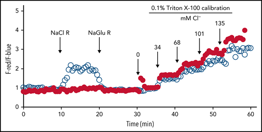 Lack of chloride influx in phagosomes of CF PMNs. Serum-opsonized zymosan particles covalently conjugated with a chloride probe (MQHA, 6-methoxyquinoline-N-6-hexanoic acid) and reference probe (TMR, tetramethylrhodamine) were ingested by normal or CF PMNs. Intraphagosomal chloride levels were continuously measured by quantitative fluorescence microscopy. The probe-laden cells were bathed in different chloride buffers in the following order: (1) sodium gluconate chloride-free Ringer’s buffer (NaGlu R), (2) sodium chloride (135 mM) Ringer’s buffer (NaCl R), and (3) chloride-free Ringer’s buffer (NaGlu R). The phagosomal chloride concentration of normal PMNs (○) rapidly respond to the change in extracellular chloride change, whereas that of CF PMN (●) had no response. At 30 minutes, a series of isoosmotic 0.1% Triton X-100 solutions containing varied chloride concentrations (0-135 mM) was introduced sequentially to calibrate the system at 6-minute intervals. Reprinted from reference 86.