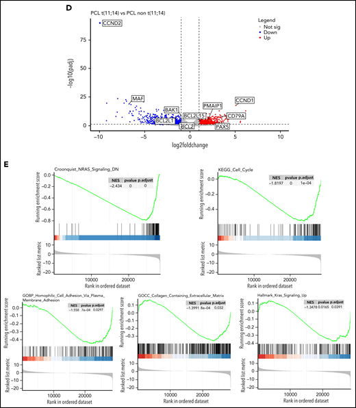 Genomic and transcriptome of malignant plasma cells from primary PCL displaying t(11;14) compared with primary PCL without t(11;14). (A) Incidence of main cytogenetics abnormalities and mutations in 46 primary PCL displaying t(11;14) compared with 44 primary PCL without t(11;14), **P < .0001, *P < .01. (B) Kaplan-Meyer overall survival of primary PCL patients according to t(11;14). (C) Unsupervised clustering of 46 primary PCL displaying t(11;14) and 44 primary PCL without t(11;14) based on the expression levels of the 100 most variable genes. (D) Gene expression profiling comparing differentially expressed genes between primary PCL displaying t(11;14) and primary PCL without t(11;14), with at least twofold change (P < .05, FDR < .01). (E) GSEA from 46 primary PCL displaying t(11;14) and 44 primary PCL without t(11;14). FDR, false discovery rate.