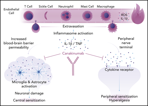 Proposed mechanism of neuroinflammation in SCA. Sickle cells and inflammatory cells in the circulation release reactive oxygen species (ROS) and proinflammatory cytokines, including IL-1β, that lead to an inflamed, porous endothelium. Inflammatory cells extravasate into the extravascular space where they trigger an inflammatory response. Inflammation causes increased blood-brain barrier permeability and chronic deleterious activation of the microglia and astrocytes that leads to neuronal damage and central sensitization (left). Inflammatory cytokines also activate receptors in peripheral nerve terminals causing peripheral sensitization and hyperalgesia (right). Both central and peripheral sensitization are responsible for chronic pain in SCA. Professional illustration by Somersault18:24.