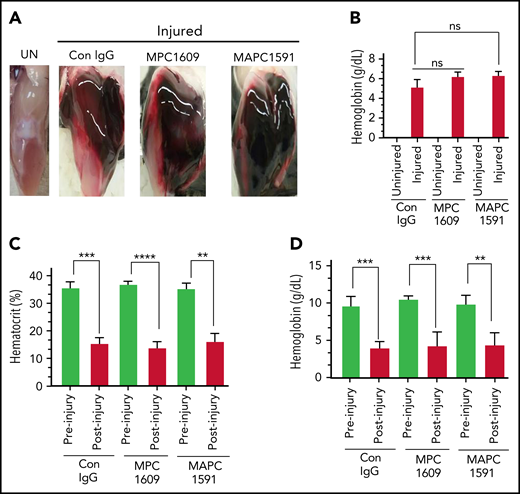 No differences in initial joint bleeding in FVIII−/− mice administered with MPC1609 and MAPC1591 following the needle puncture of the joint. FVIII−/− mice were administered with control IgG, MPC1609, or MAPC1591 (1 mg/kg) ip. Twenty-four hours later, the right knee joint capsule of the anesthetized mouse was punctured with a 30 × 0.5-g needle below the patella to induce bleeding into the joint. The left knee joint of the same animal served as uninjured control (UN). Five hours following the injury, the mice were euthanized, and the skin was removed over the knee joints. The knee joints were photographed, and joint tissues were processed to extract hemoglobin. Blood samples were collected from the submandibular vein puncture before euthanasia to measure hematocrit and hemoglobin content. (A) Representative photographs of uninjured and injured knees; (B) hemoglobin content extracted from joint tissues of uninjured and injured knees; (C) hematocrit; (D) hemoglobin levels in peripheral blood samples. ns, not statistically significant difference. **P < .01; ***P < .001; ****P < .0001 (n = 4 mice per group).