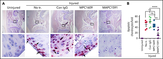 Inhibition of APC anticoagulant activity with MAPC1591 reduces joint bleed–induced chondrocyte apoptosis in hemophilia A mice. FVIII−/− mice were administered with control IgG, MPC1609, or MAPC1591 (1 mg/kg, ip). Twenty-four hours later, joint bleeding was induced by a needle puncture. Fourteen days following the injury, the knee joint was excised, sectioned, and stained with TUNEL. Red staining of chondrocytes, pointed out by arrows, indicates apoptotic chondrocytes. Top panel images were captured at ×4 magnification. The squared area was imaged at ×60 magnification (bottom panel). (B) The number of apoptotic chondrocytes was counted per high magnification field and quantified. The data shown are ± SEM. ns, not statistically significant difference. **P < .01; ****P < .0001.
