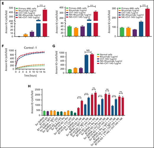 Characterization of ChT-1A5 and its induction of antibody-dependent cellular cytotoxicity in AML cell lines and primary cells. (A) Binding kinetics of anti-B7–H3 mAbs T-1A5 and ChT-1A5 to full B7-H3 protein measured by surface plasmon resonance (Octet). (B) Timelapse fluorescence data show apoptosis induced by NK-cell ADCC. U937 cells were treated with ChT-1A5 or rituximab at 1, 5, and 10 μg/mL in the presence of NK cells at an 8:1 NK:target ratio. Apoptosis was measured every hour for 30 hours. Leukemic cells were labeled with CytoLight red and apoptotic cells with annexin V (green). (C) Bar graph showing the percentage of annexin V binding at 28 hours in U937 cells treated with ChT-1A5 or rituximab at 1, 5, and 10 μg/mL in the presence of NK cells in an 8:1 NK:target ratio. Data are plotted as mean values with error bars representing standard error (Student unpaired t test). (D) Cell death kinetics represents induction of apoptosis in primary AML cells (3 patients) treated with ChT-1A5 or rituximab at 1 μg/mL in the presence of NK cells measured every hour for 12 hours for 2 patients and 36 hours in the third patient, at a 4:1 NK:target ratio. (E) Bar graphs (mean values with standard error bars) represent the percentage of cell death in primary AML cells treated with ChT-1A5 or rituximab at 1 μg/mL in the presence or absence of NK cells at a 4:1 NK:target ratio at 12, 12, and 36 hours, from left to right. (Student unpaired t test). (F) Cell death kinetics and bar diagram (G) represent induction of apoptosis in PBMCs derived from healthy donors (Control-1). PBMCs were treated with ChT1-A5 mAb or rituximab at 1 μg/mL in the presence or absence of NK cells (8:1 effector:target ratio); PBMCs were labeled with CytoLight red, and annexin V. (H) Bar graph (mean values with standard error bars) represent the percentage of cell death in primary AML cells treated with ChT-1A5/T-1A5 or combination of ChT1-A5 and T-1A5 at 1 μg/mL in the presence or absence of NK cells at a 2:1 NK:target ratio at 76 hours (Student unpaired t test). NS not significant; Rx, rituximab; Scr, scrambled. ***P < .0001.