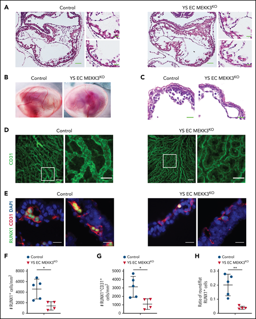 Lyve1-Cre mediated loss of MEKK3 impairs definitive hematopoiesis in the yolk sac despite preserved cardiac development. (A) Hematoxylin and eosin (H&E)-stained sections of E10.5 control and Lyve1-Cre;Map3k3f/f (YS EC MEKK3KO) hearts. Scale bars, 50 μm. Boxed regions are shown at higher magnification on the right; scale bars, 20 μm. N = 3 for each genotype. (B) E10.5 control and YS EC MEKK3KO embryos surrounded by intact yolk sacs. Scale bars, 500 μm. Representative of n = 8 to 10 embryos of each genotype. (C) H&E-stained sections of E10.5 control and YS EC MEKK3KO yolk sacs. Note the reduced number of round hematopoietic cells in the YS EC MEKK3KO vascular lumen despite preserved vessel size. Representative of n = 8 to 10 embryos of each genotype at both timepoints. Scale bars, 20 μm. (D) Confocal images of E9.5 control and YS EC MEKK3KO yolk sacs stained for CD31. Scale bars, 100 μm. Boxed regions are shown at higher magnification on the right. Scale bars, 50 μm. Representative of 5 embryos per genotype. (E) E10.5 control and YS EC MEKK3KO yolk sac sections stained for CD31 and RUNX1. Scale bars, 20 μm. (F) The number of RUNX1+ cells per mm2 of vascular area. (G) The number of RUNX1+ CD31+ cells per mm2 of vascular area. (H) The ratio of round/flat RUNX1+ cells in E10.5 control and YS EC MEKK3KO yolk sacs. Each data point in panels F-G represents the mean of >25 vessels in a single animal’s yolk sac. N = 5 E10.5 control and 4 E10.5 YS EC MEKK3KO yolk sacs. Error bars represent ± standard deviation; significance determined by an unpaired, 2-tailed Student t test. *P < .05; **P < .01.