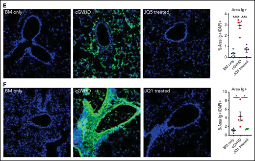JQ5 and JQ1 treat murine cGVHD/BO. Results are from BO cGVHD transplants. B10.BR mice were conditioned with 120 mg/kg Cytoxan (cyclophosphamide) (days −3, −2) and 7.6 Gy total body irradiation (TBI) (day −1). On day 0, recipients received 10 × 106 purified BM cells ± 73.5 × 103 B6 purified T cells from C57BL/6. Groups included a BM-only negative control, a WT BM and T-cell–positive control, and mice that were given each treatment either JQ5 (75 mg/kg 3×/wk) or JQ1 (50 mg/kg 3× per week) from day 28 to day 49 posttransplant. Results shown are pooled from 3 transplant replicates. Results of pulmonary function tests taken on day 49 posttransplant include measures of resistance, elastance, and compliance. Significant improvement in pulmonary function across multiple parameters was observed with both JQ5 (A; n = 22/BM-only, n = 17/cGVHD, n = 15/JQ5) and JQ1 (B; n = 18/BM-only, n = 20/cGVHD, n = 18/JQ1) treatment. Representative images of cryopreserved lung sections from mice 49 days posttransplant. (C-D) Sections were stained with Masson trichrome and analyzed for collagen deposition. Quantification of the trichrome positive area is in the furthest right panel. This deposition is significantly reduced in both the JQ5-treated mice (C; n = 8/BM-only, n = 11/cGVHD, n = 8/JQ5) and the JQ1 treated mice (D; n = 7/BM-only, n = 8/cGVHD, n = 8/JQ1). (E-F) Sections were stained with anti IgG FITC and DAPI and show a reduction of IgG+ tissue in both JQ5-treated mice (E; n = 5/BM-only, n = 5/cGVHD, n = 4/JQ5) and the JQ1-treated mice (F; n = 5/BM-only, n = 5/cGVHD, n = 4/JQ1). Quantification of FITC+ area is shown in panels furthest to the right. All images are at ×200 magnification. Statistics shown are results of an unpaired t test with Bonferroni corrected P values when appropriate. *P < .05, **P < .01, ***P < .001, ****P < .0001.