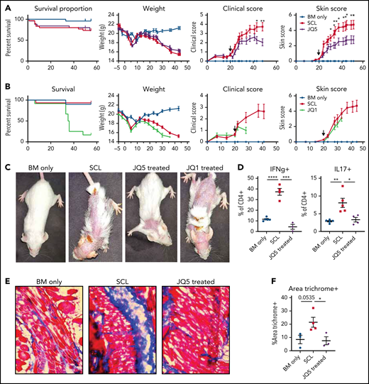 Treatment with JQ5, but not JQ1, can treat sclerodermatous cGVHD. (A-C) BALB/c mice were given TBI (700 cGy on day −1) followed by infusion of 107 B10.D2 BM ± 1.8 × 106 CD4 and 0.9 × 106 CD8 T cells (day 0). JQ5- and JQ1-treated mice received treatment as in Figure 1 from days 20 to 45 posttransplant, n = 25/group. (A-B) From left to right, graphs show impact of JQ5 treatment on recipient survival, mean weights, clinical scores, and skin scores. Arrows on clinical and skin score plots indicate time of treatment initiation. (A) Although JQ5 did not significantly improve either weights or survival proportion, treated mice showed significantly reduced clinical scores, and skin scores as early as 10 days after initial treatment. (B) JQ1 treatment shows evidence of toxicity within 7 days of beginning therapy with no mice surviving beyond 2 weeks after treatment initiation. (C) Representative images of sclerodermatous mice with or without treatment with each drug. Images taken 45 days posttransplant, except for JQ1-treated mouse, where image was taken 34 days posttransplant. (D) Flow cytometry analysis of cytokine production from transplanted mouse lymph nodes shows a significant reduction in inflammatory cytokine production with JQ5 treatment, indicative of reduced disease, n = 5 per group. (E) Representative images of cryopreserved skin cross sections from mice 45 days posttransplant. Sections were stained with Masson trichrome. Images are ×200 magnification. (F) Quantification of trichrome+ area of skin cross sections in panel C shows a significant reduction in trichrome-positive area with JQ5 treatment, n = 4 per group. This correlates to a reduction in skin collagen deposition with treatment. *P < .05, **P < .01, ***P < .001, ****P < .0001.