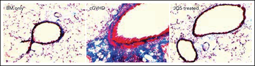 Significant histologic improvement in the lungs of JQ5 treated animals. See the complete Figure 1 in the article by Zaiken et al that begins on page 2983.
