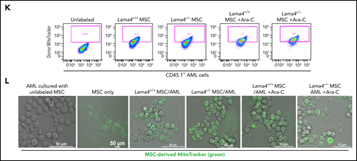 Lama4−/− niche confers AML cell chemoresistance to Ara-C via modulating ROS levels associated with increased mitochondrial transfer from MSCs to AML cells. (A) AML onset and survival of Lama4+/+ and Lama4−/− mice following injection of DsRed-expressing MLL-AF9+ cells. The mice were irradiated with 6 Gy prior to the AML cell injection. The AML engraftment in PB was analyzed by FACS 14 days after AML cell injection. The mice were then injected with normal saline (NS) or Ara-C for 5 days starting at day 15. (B) Spleen size in Lama4+/+ and Lama4−/− mice 1 to 3 days post-Ara-C or NS treatment. (C) The frequency of residual total AML cells (left) and enrichment of chemoresistant CD36+ AML cells (right) in Lama4+/+ and Lama4−/− mouse BM at 1 day after the last injection of Ara-C. The percent of CD36+ cells were presented as fold changes relative to the average percent of the cells in NS-treated mice. (D) ROS levels in the AML cells from Lama4+/+- and Lama4−/−-recipient PB at 14 days post-AML cell injection. The left panel shows MFI of ROS in the AML cells, and the right panel is representative FACS histograms of ROS levels. (E) ROS levels in the AML cells from Lama4+/+- and Lama4−/−-recipient BM at 1-day post-Ara-C treatment. The data shown are the MFIs of ROS (left) and fold changes (right) in ROS levels in the AML cells post-Ara-C treatment relative to the mean values in NS-treated mice in each experiment. (F) Experimental setup for testing mitochondrial transfer from MSCs to AML cells. The MLL-AF9+ AML cells were cocultured with Lama4+/+ and Lama4−/− MSCs prelabeled with MitoTracker green. The MSC-derived mitochondria were analyzed for the MFI of MitoTracker in AML cells at 24 hours postcoculture by FACS and confocal microscopy. (G) Simultaneous detection of ROS, mitochondrial mass (Mitotracker+), and mitochondrial membrane potential (MMP) Tetramethylrhodamine methyl ester perchlorate (TMRM)+ in Lama4+/+ and Lama4−/− MSCs prior to the cocultures. (H) Representative FACS histograms showing MFIs of MitoTracker, TMRM, and ROS in the MSCs prior to the cocultures. (I) Increased mitochondrial mass in Lama4−/− MSCs cocultured with AML cells. Data shown are fold changes in MitoTracker MFI in Lama4−/− MSCs compared with that in Lama4+/+ MSCs. (J) Mitochondrial transfer from BM MSCs to AML cells in the cocultures with and without Ara-C treatment. Data shown are relative MitoTracker MFI in the AML cells cocultured with Lama4−/− MSCs to that with Lama4+/+ MSCs. (K) Representative FACS profiles showing mitoTracker+ AML cells 24 hours postcoculture with Lama4+/+ and Lama4−/− MSCs. (L) Confocal images showing MSC-derived mitochondria (green) in the AML cells at 24 hours postcoculture. The data shown are from 2 to 4 independent experiments, and horizontal bars show median values. The P values shown in the panels were determined by 2-tailed or 1-tailed unpaired Student t test. See also in supplemental Figure 10-11.