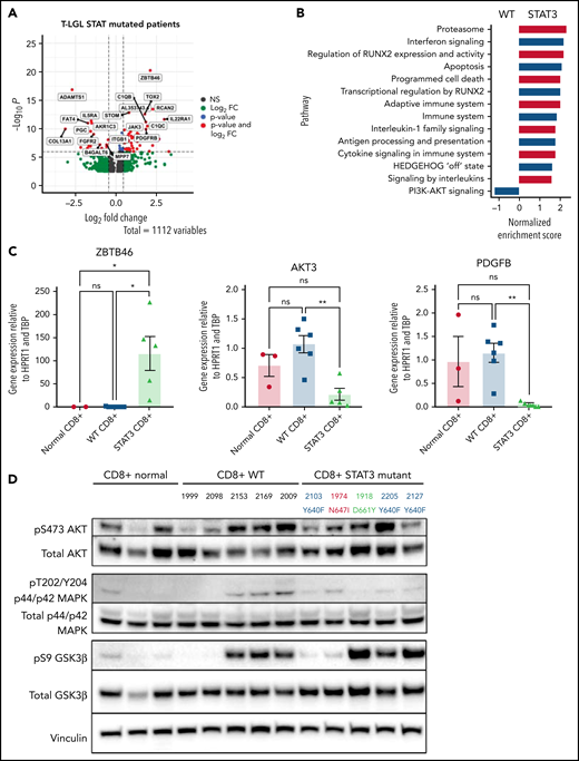 Transcriptomic and protein expression comparison of STAT3-mutated patients against STAT3-WT patients. (A-B) RNA-seq analysis of T-LGL leukemia patients. (A) Volcano plot of DESeq2 output of T-LGL STAT3 mutant vs STAT3 WT. Genes with positive log2 fold changes are more highly expressed in STAT3 mutants, and genes with negative log2 fold changes are more highly expressed in STAT3 WT. (B) Gene set enrichment analysis of the nodes from the functional modular network analysis. Positive enrichment scores indicate pathways that are positively enriched in STAT3-mutant patients. Negative enrichment scores indicate pathways enriched in STAT3-WT patients. (C) RT-qPCR comparison of mRNA levels of ZBTB46, AKT3, and PDGFB from CD8+-isolated normal controls (n = 3; ZBTB46 n = 2 due to signal below the limit of detection in 1 sample), WT (n = 6; ZBTB46 n = 5 due to signal below the limit of detection in 1 sample), and STAT3-mutant LGL patient samples (n = 5). Analysis of variance (ANOVA) P = .028, .014, and .018 for ZBTB46, AKT3, and PDGFB, respectively. (D) Western blotting of pS473 AKT, total AKT, phospho-p44/42 MAPK, total p44/42 MAPK, pS9 GSK3β, and total GSK3β from CD8+-isolated normal controls (n = 3) compared with WT and STAT3-mutant LGL patient samples (n = 5). STAT3 mutation type and LGL registry ID are indicated. (E) RT-qPCR comparison of mRNA levels of STAT3, STAT1, and PDGFRB from CD8+-isolated normal controls, WT, and STAT3-mutant LGL patients. ANOVA P = .049, .963, and .026 for STAT3, STAT1, and PDGFRB, respectively. (F) Western blotting of pSTAT3, total STAT3, pSTAT1, total STAT1, total PDGFRβ, and vinculin loading control from CD8+-isolated normal controls compared with WT and STAT3-mutant LGL patient samples. STAT3 mutation type and LGL registry ID are indicated. Welch’s or Brown-Forsythe ANOVA was used for all RT-qPCR analyses depending on the distribution of the data. Unpaired t with Welch’s correction as a post hoc test. P values are indicated as follows: *P < .05; **P < .01.