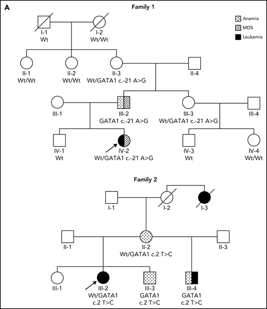 Identification of GATA1 mutations in affected members of 2 families. (A) Pedigree diagram of families. Arrows indicate index cases. (B) Schematic diagram of normal GATA1 gene splicing and translation and the impact of the c.-21 A>G and c.2 T>C variants. mRNA, messenger RNA; Wt, wild type.