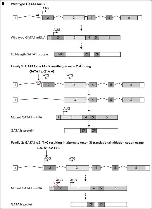Identification of GATA1 mutations in affected members of 2 families. (A) Pedigree diagram of families. Arrows indicate index cases. (B) Schematic diagram of normal GATA1 gene splicing and translation and the impact of the c.-21 A>G and c.2 T>C variants. mRNA, messenger RNA; Wt, wild type.