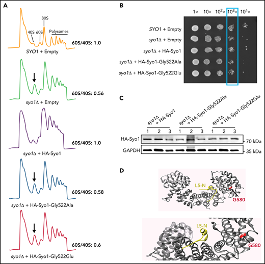 The HEATR3 Gly584 (yeast Gly522) residue is important for protein function. (A) Polysome profiles of wild-type and syo1Δ yeast cells expressing empty vector controls or HA-tagged Syo1-Gly522 mutations display an altered 60S/40S subunits ratio. Representative examples of a duplicate are shown. (B) Mutations at position Gly522 do not complement yeast growth. The mild growth impairment observed in syo1Δ cells is complemented by a wild-type construct (HA-Syo1) but not by constructs harboring a mutation at position Gly522. The indicated strains were grown at 16°C on synthetic medium lacking leucine for 6 days. (C) The Gly522 mutants are stably expressed in yeast. HA-Syo1 constructs were detected by western blotting with an anti-HA antibody. As loading control, glyceraldehyde-3-phosphate dehydrogenase (GAPDH) probing was performed. (D) Position of yeast mutation Gly522 on the three-dimensional structure of C thermophilum Syo1 in complex with L5-N (based on PDB 4GMN25). Yeast Gly522 corresponds to Gly584 in the C-terminal (supplemental Figure 1). Two views are shown.