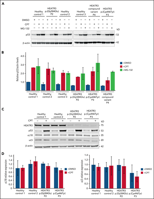 HEATR3 loss does not affect levels of p53, uL5, or uL18. (A) Western blots of LCLs exposed to either 100 nM camptothecin (CPT) for 4 hours, or 10 µM MG-132 for 6 hours, or the vehicle control, dimethyl sulfoxide (DMSO). Blots shown are probed with antibodies against p53. HEATR3 variants do not lead to p53 stabilization on their own but they do, as expected, in combination with CPT or MG-132 treatments. (B) Quantification of panel A from 3 independent experimental replicates. Results shown are the relative levels of p53/actin. (C) Western blots of LCLs exposed to 100 nM CPT for 4 hours, or the vehicle control, DMSO. Blots shown are probed with antibodies against HEATR3, p53, uL5, and uL18. (D) Quantification of panel C from 3 independent experimental replicates. Results shown are the relative levels of uL5/actin or uL18/actin.