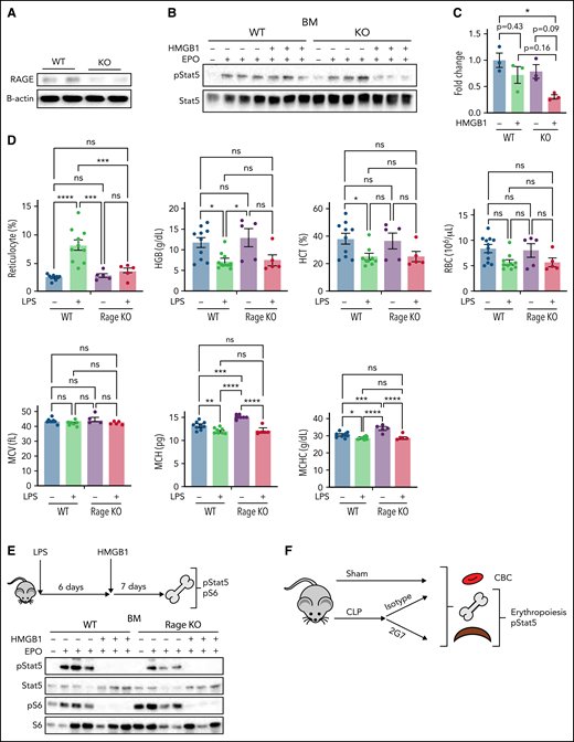 Anti-HMGB1 monoclonal antibody rescues EPO signaling in murine model of sepsis. (A) RAGE expression levels measured by western blot in the bone marrow of WT vs Rage−/− mice. (B) pSTAT5 levels measured by western blot in ex vivo EPO stimulation assays in the total nucleated bone marrow population from WT and Rage−/− in the presence or absence of HMGB1. (C) Quantification of the levels of pSTAT5 in the indicated conditions expressed as fold change compared with pSTAT5 levels in WT in the absence of HMGB1. (D) Complete blood counts in WT and Rage−/− mice 6 days after LPS treatment. (E) Seven days after HMGB1 treatment in vivo, pSTAT5 and pS6 levels measured by western blot in ex vivo EPO stimulation assays in the total nucleated bone marrow population from WT and Rage−/− in the presence or absence of an additional dose of HMGB1. Sepsis was induced by cecal ligation and puncture (CLP) or not (eg, sham) in groups of mice. At 9 days after sepsis induction, mice were treated with isotype IgG or neutralizing anti-HMGB1 mAb (2G7) for 3 consecutive days. All data were collected at D21 after the CLP procedure. (F) Schematic of experimental design. (G) Representative flow cytograms with gating strategy of bone marrow terminal erythroid differentiation using Ter119 and CD71 surface markers. (H) Representative histograms of bone marrow ProEB pSTAT5 levels by phosphoflow. (I) Quantification of pSTAT5 levels in the ProEB, CD71High and CD71Low populations from bone marrow by phosphoflow expressed as fold change compared with pSTAT5 levels in mice treated with the isotype control. (J) Red cell and platelet indices of isotype and 2G7-treated CLP mice. Data presented as mean ± SEM. (C-D,I) One-way ANOVA with Tukey’s post hoc test: *P < .05; ns, not significant. (J) Unpaired, 2-tailed Student t test: **P < .01; ns, not significant.