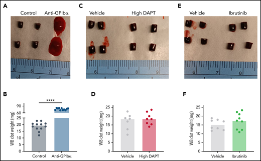 Inhibition of GPCR or ITAM signaling in mouse platelets does not impair whole-blood (WB) clot formation in vitro. Recalcified WB was clotted with tissue factor. After 2 hours, clots were visualized and weighed. Representative images and clot weights of WB clots from mice treated with anti-GPIbα antibodies (A-B), high DAPT (C-D), or ibrutinib (E-F). Dots represent individual mice, bars indicate medians. ****P < .0001.